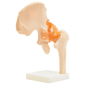 Human Hip Joint Anatomy Model (11.5 x 7 in)